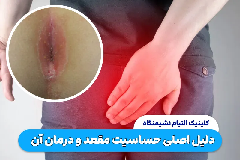 دلیل حساسیت مقعد