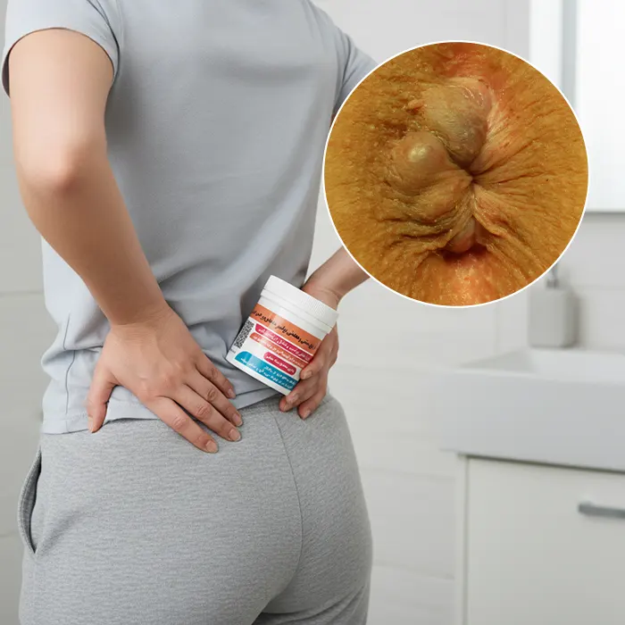 مرهم بواسیر لارا