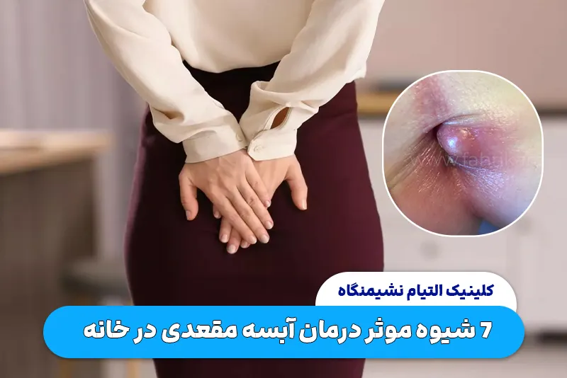 7 شیوه موثر درمان آبسه مقعدی در خانه