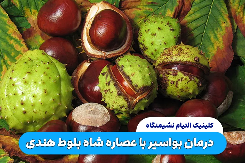 درمان بواسیر با عصاره‌ شاه‌ بلوط هندی