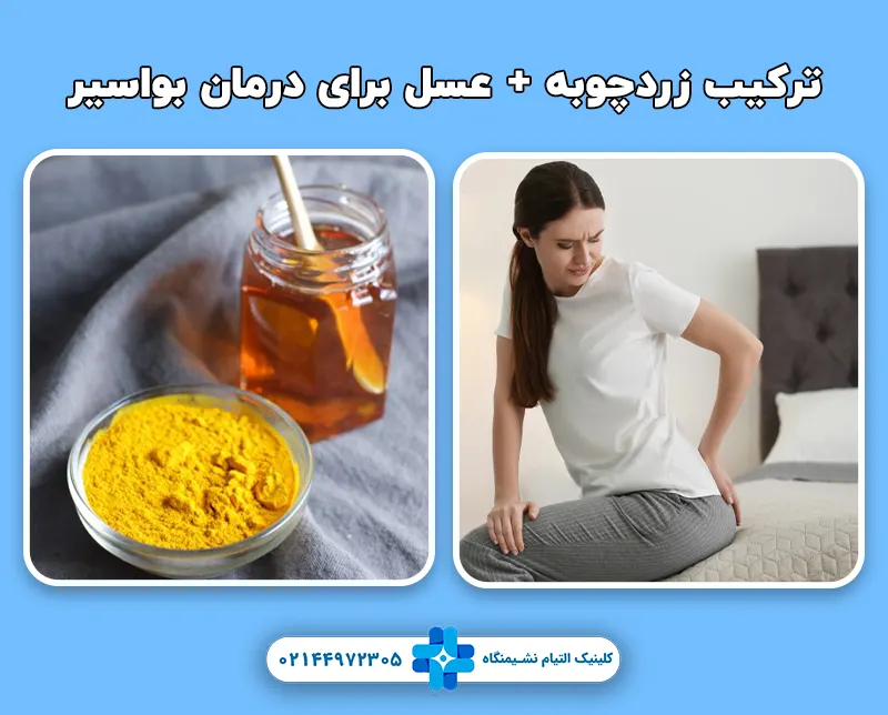 ترکیب زردچوبه و عسل
