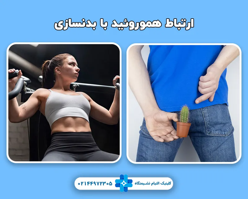 ارتباط هموروئید با بدنسازی