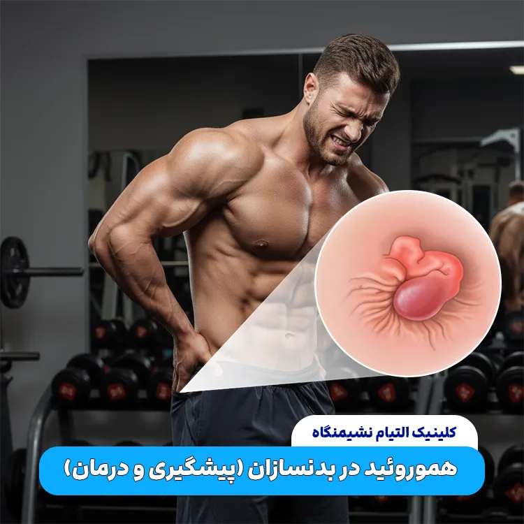 تاثیر بدنسازی بر بواسیر