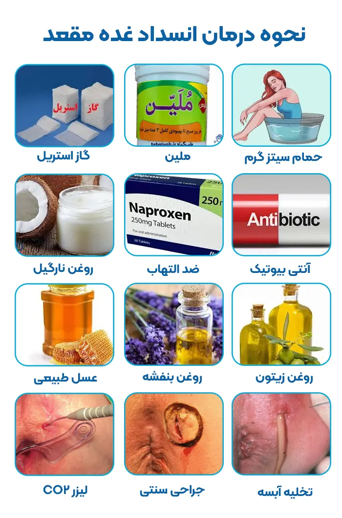 درمان انسداد غده مقعد