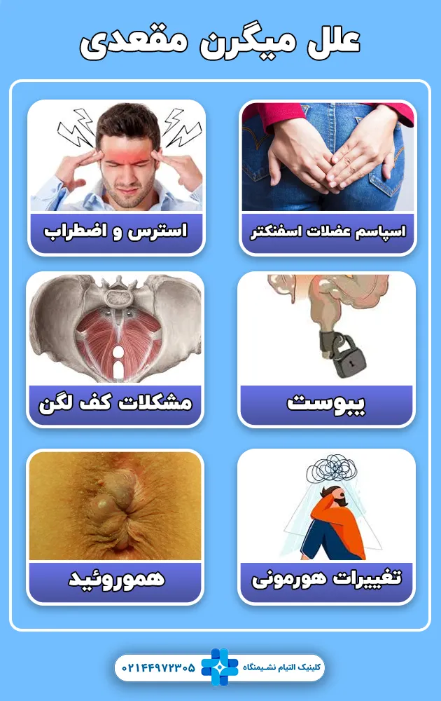 علل میگرن مقعدی