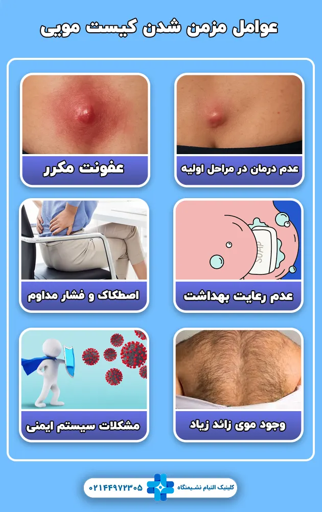 چه عواملی باعث مزمن شدن کیست مویی می شود؟