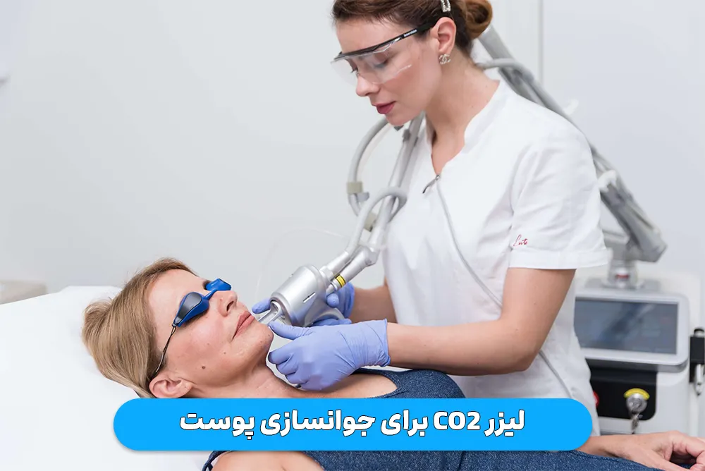 لیزر co2