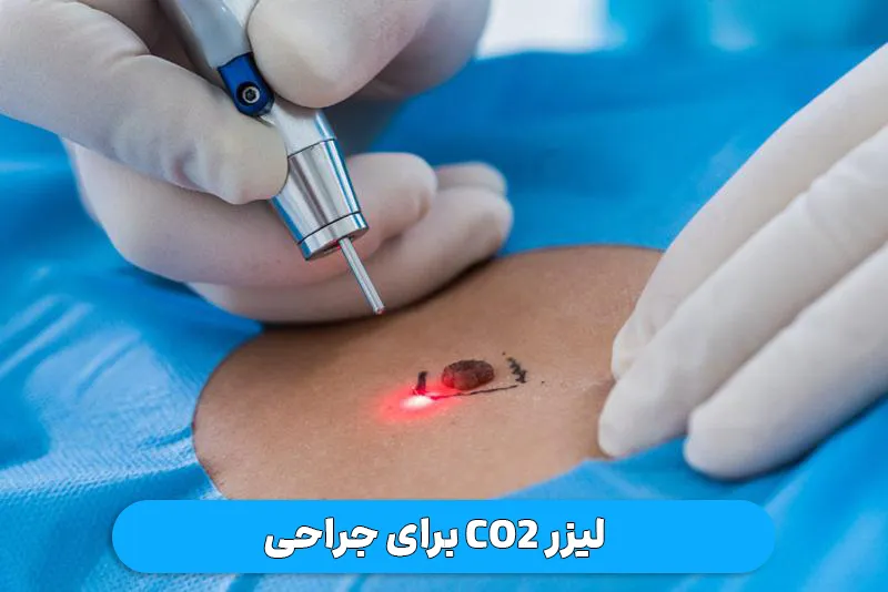 لیزر co2 برای جراحی