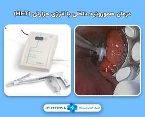 درمان هموروئید داخلی با انرژی حرارتی (HET) بدون جراحی