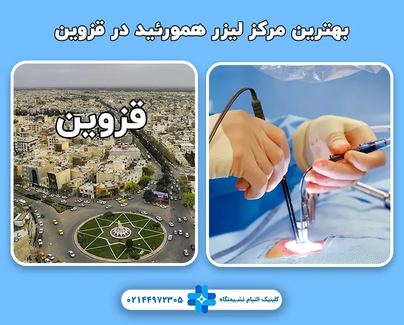 بهترین مرکز لیزر همورئید در قزوین