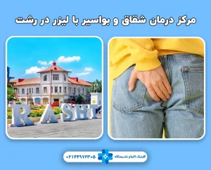 مرکز درمان شقاق و بواسیر با لیزر در رشت