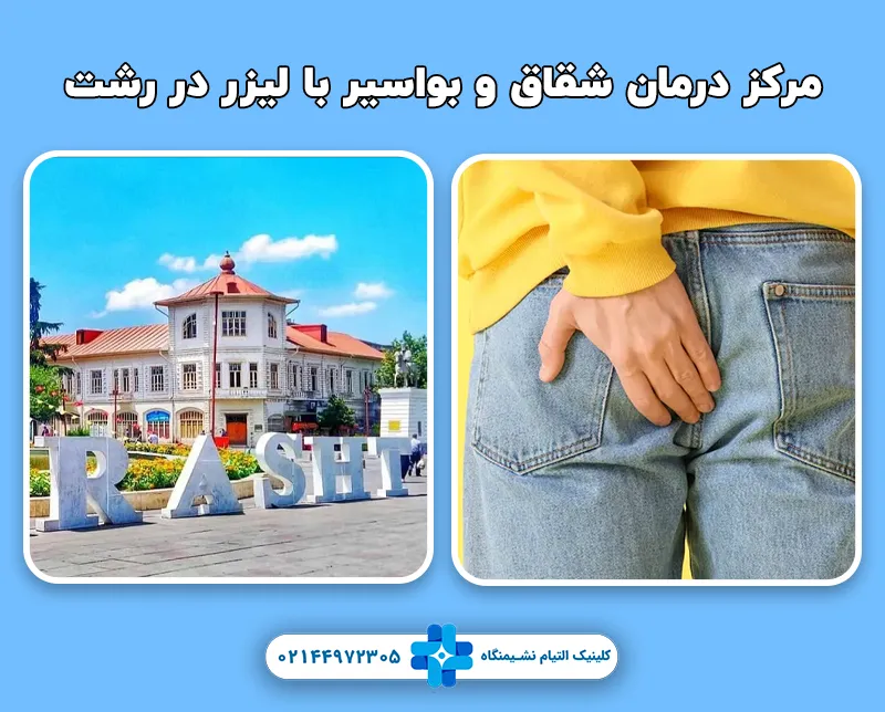 مرکز درمان شقاق و بواسیر با لیزر در رشت