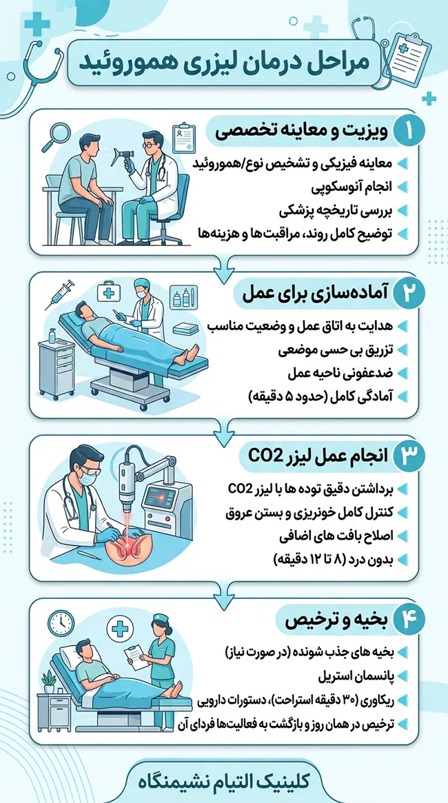 مراحل درمان لیزری هموروئید