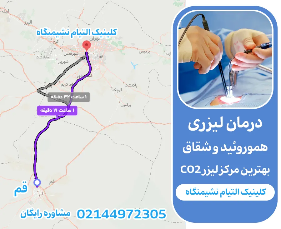 مرکز لیزر هموروئید التیام نشیمنگاه