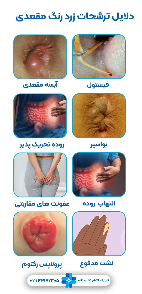دلایل ترشحات زرد رنگ مقعدی