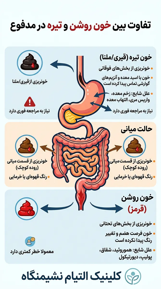 تفاوت مدفوع خونی روشن و تیره