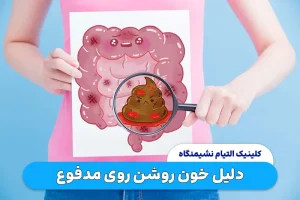 دلیل خون روشن روی مدفوع