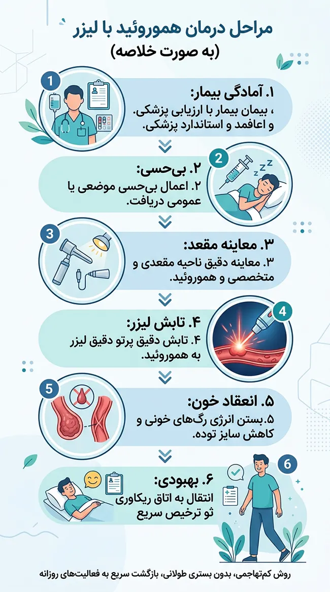 مراحل لیزر بواسیر