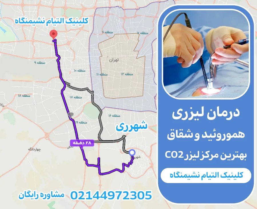 لیزر هموروئید و شقاق در شهرری