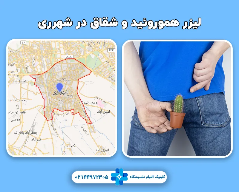 لیزر هموروئید و شقاق در شهرری