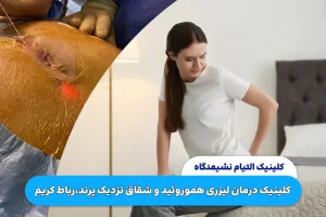 کلینیک درمان لیزری هموروئید و شقاق نزدیک پرند،رباط کریم