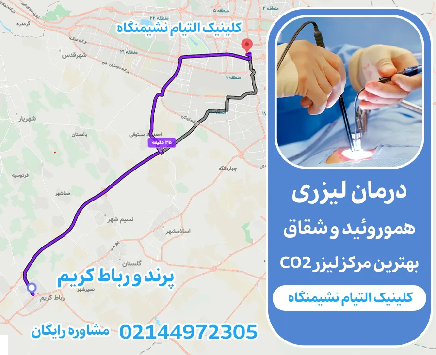لیزر شقاق و بواسیر برای ساکنین پرند و رباط کریم