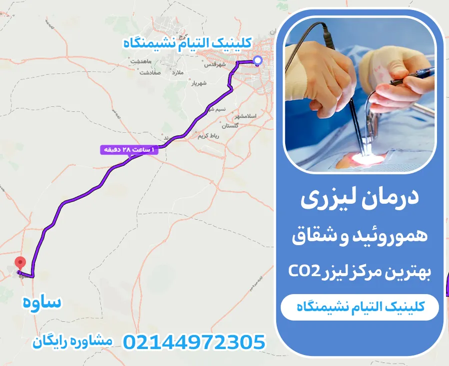 درمان بواسیر و کیست مویی برای ساکنین ساوه