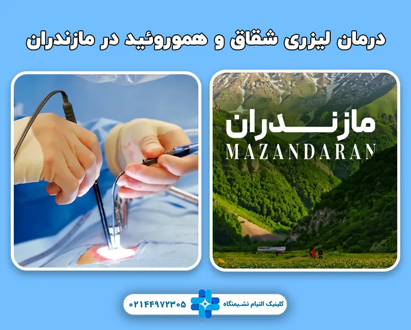 درمان لیزری شقاق و هموروئید در مازندران