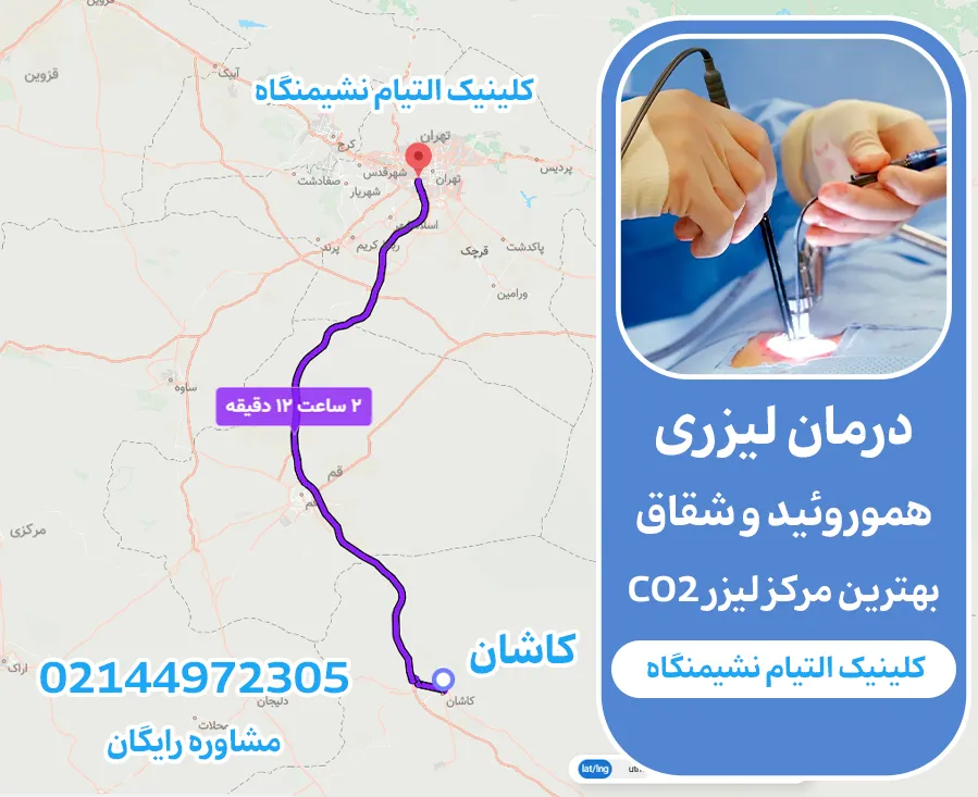 لیزر هموروئید کاشان