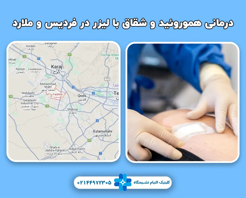 مرکز درمانی هموروئید و شقاق با لیزر در فردیس و ملارد