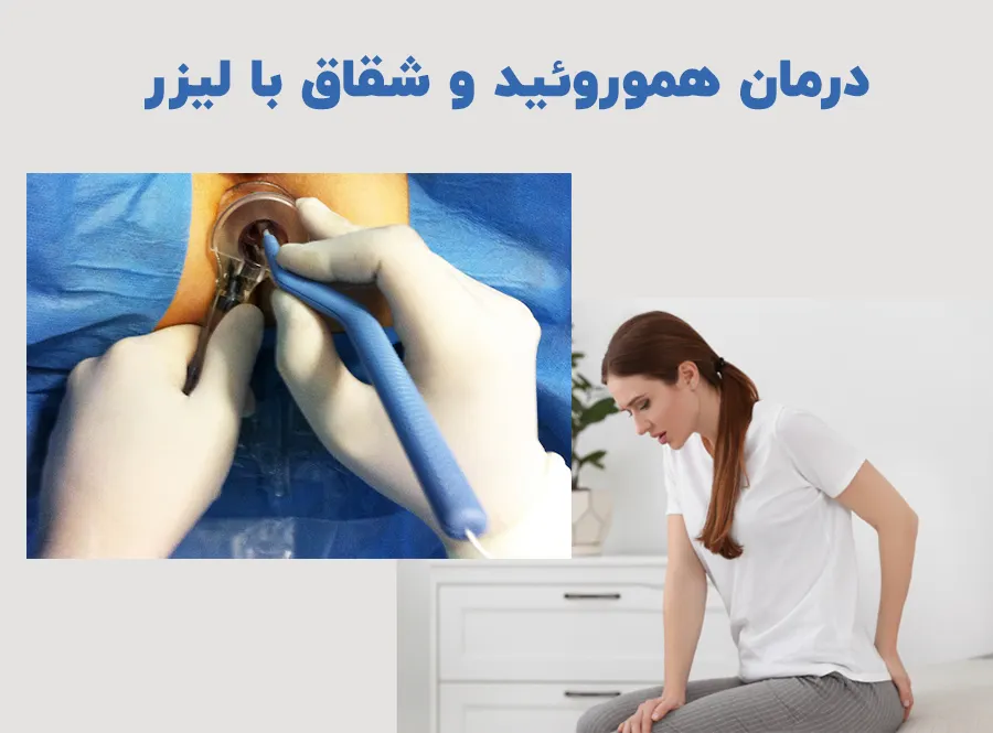 درمان لیزر هموروئید و شقاق