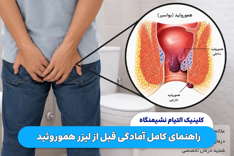 راهنمای کامل آمادگی قبل از لیزر هموروئید