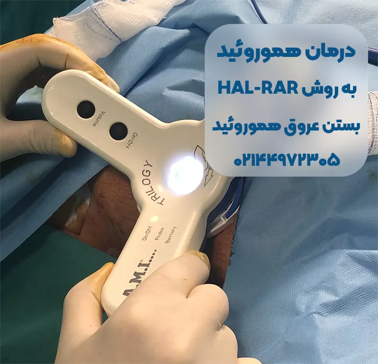 درمان هموروئید به روش HAL-RAR