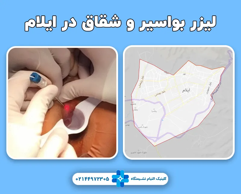 کلینیک لیزر بواسیر و شقاق در ایلام
