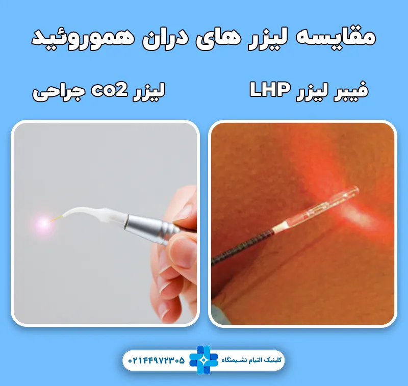 تفاوت لیزر LHP با لیزر co2 پرتوان در درمان هموروئید