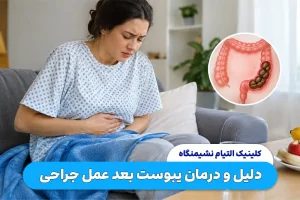 چرا بعد از عمل جراحی دچار یبوست می شویم؟